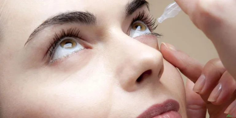 کراتوکنژنکتیویت آتوپی(Atopic keratoconjunctivitis)  چیست؟
