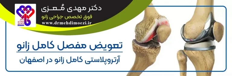 درمان قطعی پوکی استخوان شدید