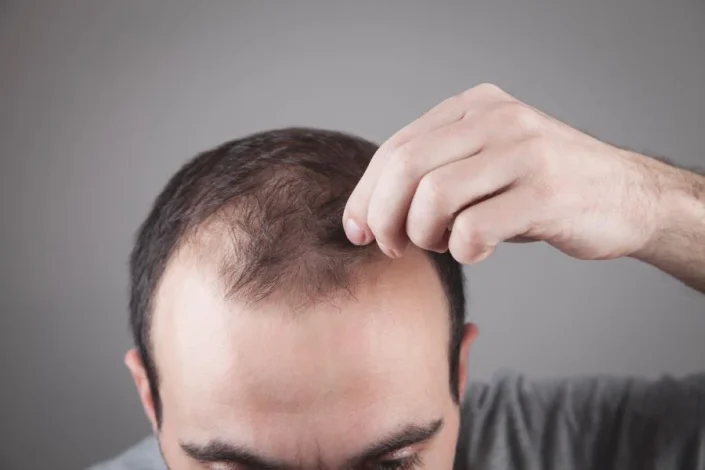 The best hair loss treatment