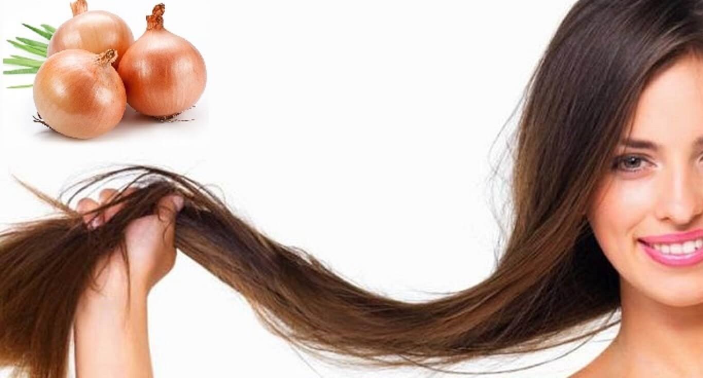 Treatment of hair loss in women