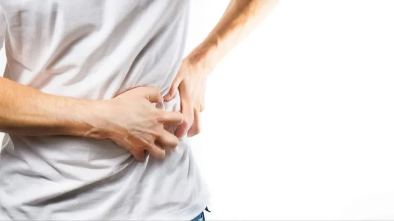 آیا سنگ کلیه باعث نفخ میشود؟