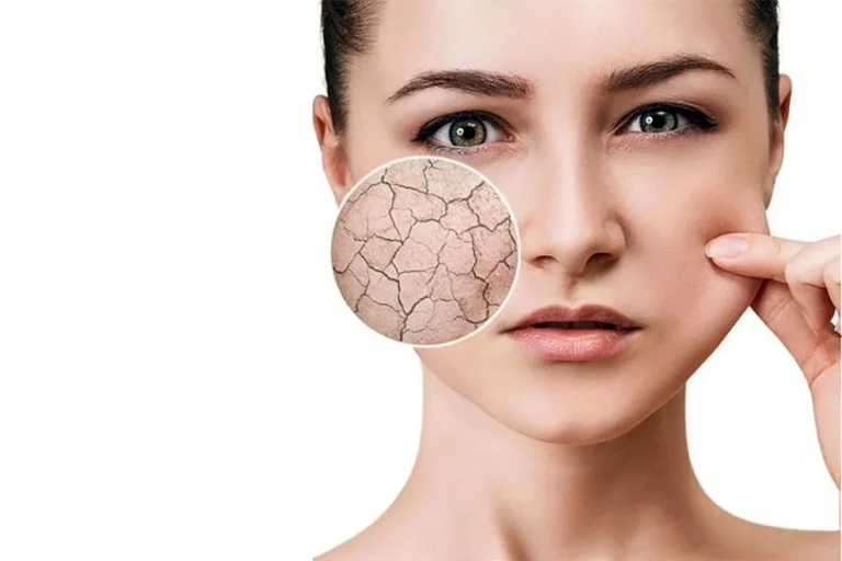چرا پوست را لایه برداری کنیم؟