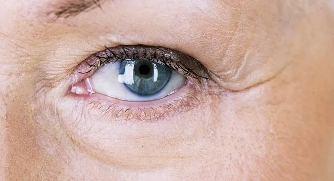 Why is the skin around the eyes dry?