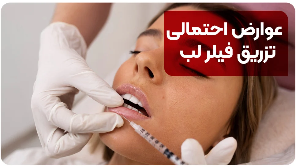 عوارض احتمالی تزریق فیلر لب