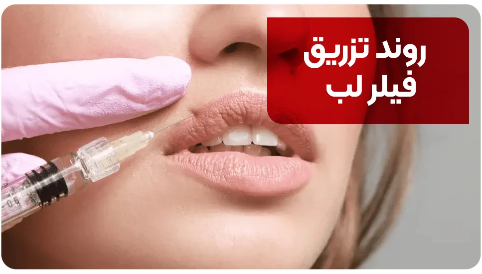 روند تزریق فیلر لب